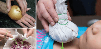 Natural Onion Remedies