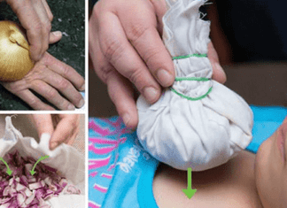 Natural Onion Remedies