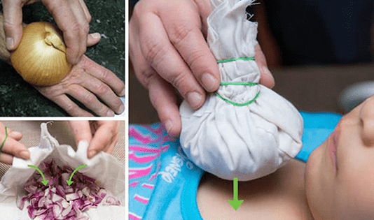 Natural Onion Remedies
