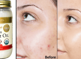 Clear And Spotless Skin