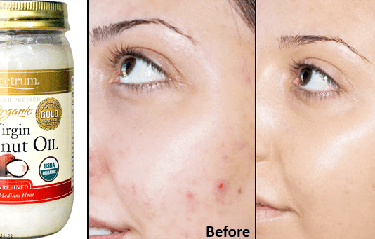 Clear And Spotless Skin