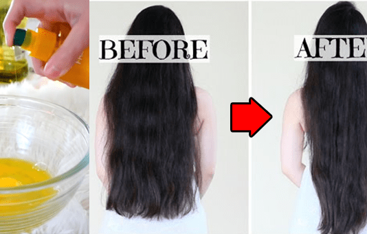 Grow Hair In 1 Day