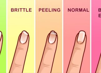 nails say about health