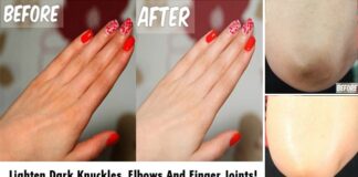 Lighten Dark Knuckles, Elbows And Finger Joints