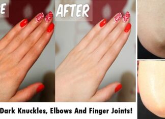 Lighten Dark Knuckles, Elbows And Finger Joints