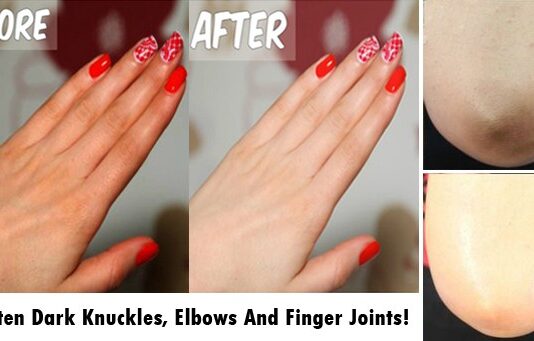 Lighten Dark Knuckles, Elbows And Finger Joints