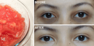 Remove Dark Circles In 3 Days