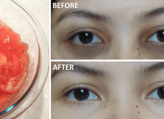 Remove Dark Circles In 3 Days