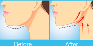 Get Rid Of A Double Chin