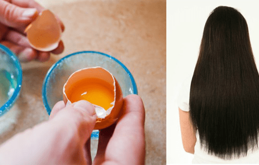 How To Use Eggs For Hair Growth And Prevent Hair Loss Hair Growth