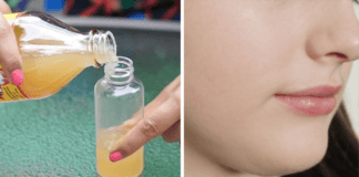 Apple Cider Vinegar For Skin