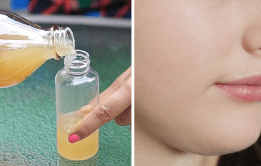 Apple Cider Vinegar For Skin