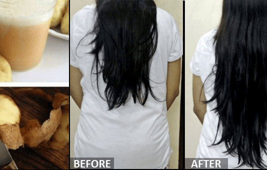 What Makes Your Hair Grow Faster? These 5 Things Hair Grow Faster