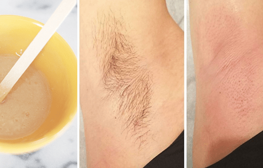 How To Get Rid Of Underarm Hair At Home
