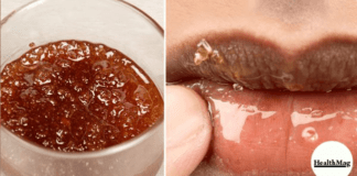 Get Rid Of Dry Dark Lips