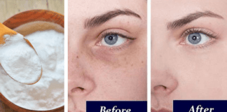 Remove Dark Circles