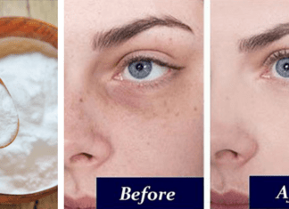 Remove Dark Circles
