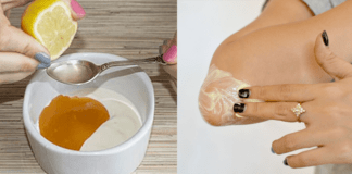 Get rid of dark knees and elbows