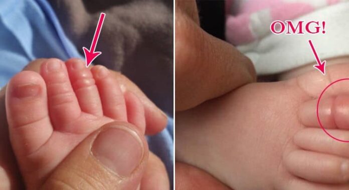 baby (1)