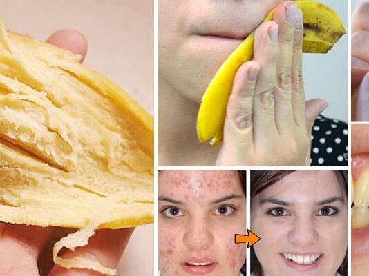 Benefits of the banana peel