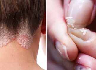 Signs that shows your health is deteriorating!