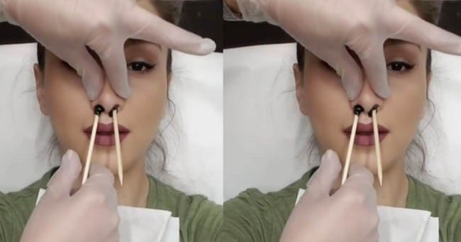 Nose-waxing-1 (1)