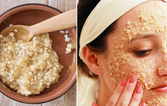 Get Rid Of Oily Skin With The Help Of These 4 Home Remedies !! Get Rid Of Oily Skin