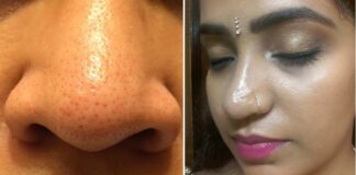 get rid of the oily nose