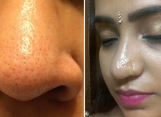 get rid of the oily nose