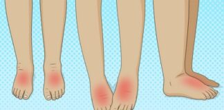 Causes of swollen feet