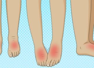 Medical Conditions That Could Be The Reason Why Your Feet Swell Causes of swollen feet