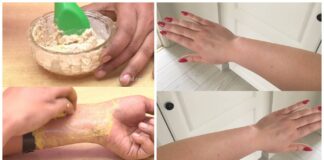 Protect your skin from tanning