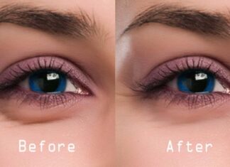 Get rid of eye bags