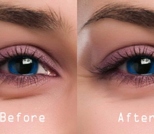 Smart tips to move away eye bags Get rid of eye bags
