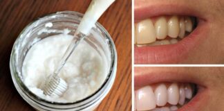 whiten your teeth