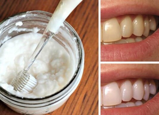Homemade remedy to whiten your teeth whiten your teeth