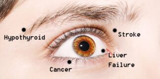 What eyes say about your health