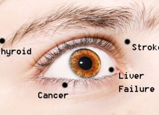 What eyes say about your health
