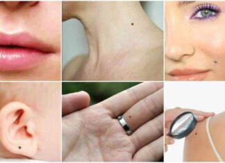 The position of your moles will reveal interesting facts about your personality