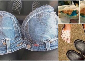 30+ Unfortunate Things That Happened To People