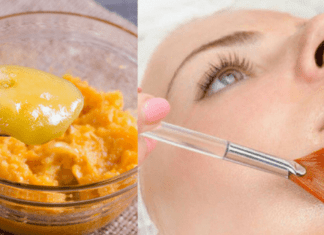 Get rid of excessive tanning