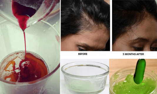 Miracle hair mask for faster hair growth