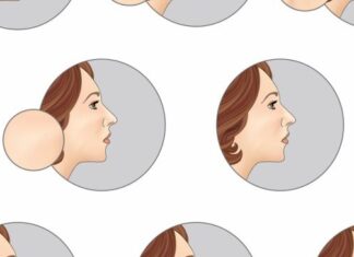 Foods that are Toxic for Your Skin