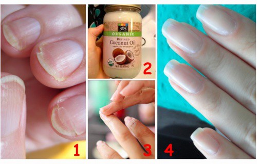 How-to-Use-Coconut-OIl-For-Split-Nails-and-Overall-Beauty