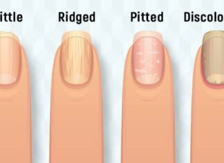 What Does Your Fingernails Indicate About Your Health