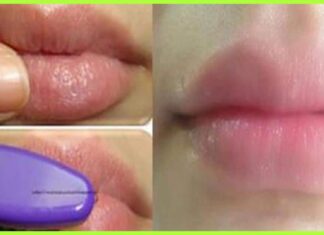 Seven Best Ways To Lighten Up Your Upper Lips Very Easily.