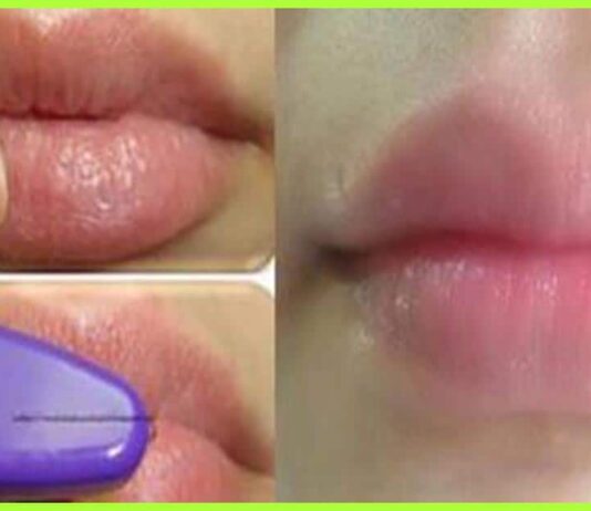 Seven Best Ways To Lighten Up Your Upper Lips Very Easily.