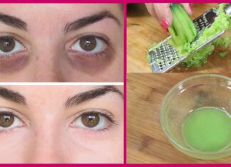 Best Homemade Ways To Get Rid Of Dark Circles Naturally – Easy And Effective