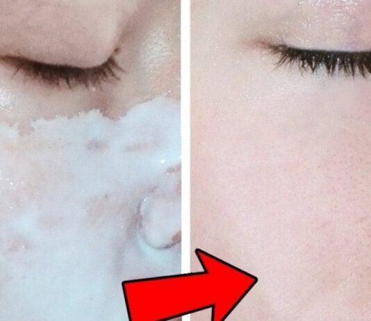 Follow These Tips To Get Beautiful Skin In Two Months Time