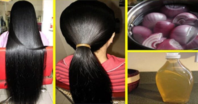 check out these onion recipes for your hair check out these onion recipes for your hair